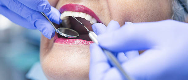 Best Emergency Dental Care for Broken or Chipped Teeth in Arcadia, IN